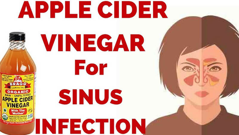 Apple cider vinegar for sinus